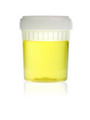 urine geel